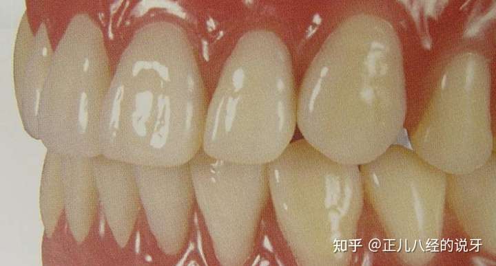 天生牙齿很黄是什么原因?