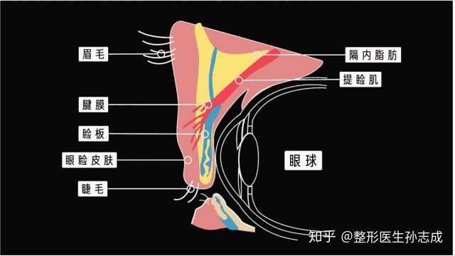 能贴出来双眼皮要不要去割