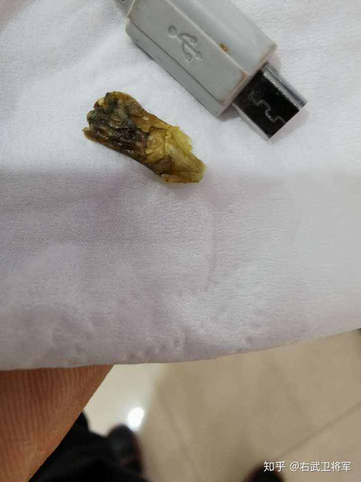 经常掏耳屎的人耳朵里还会有那种超大的耳屎就像一些视频里拍的那样吗