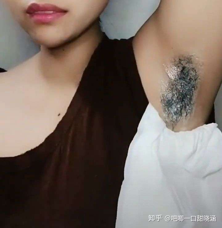 女生腋下汗毛很浓密怎么去除