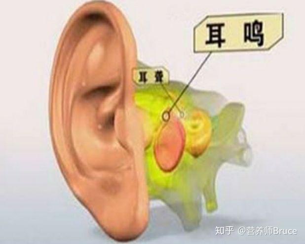 耳鸣是什么原因引起的到底?