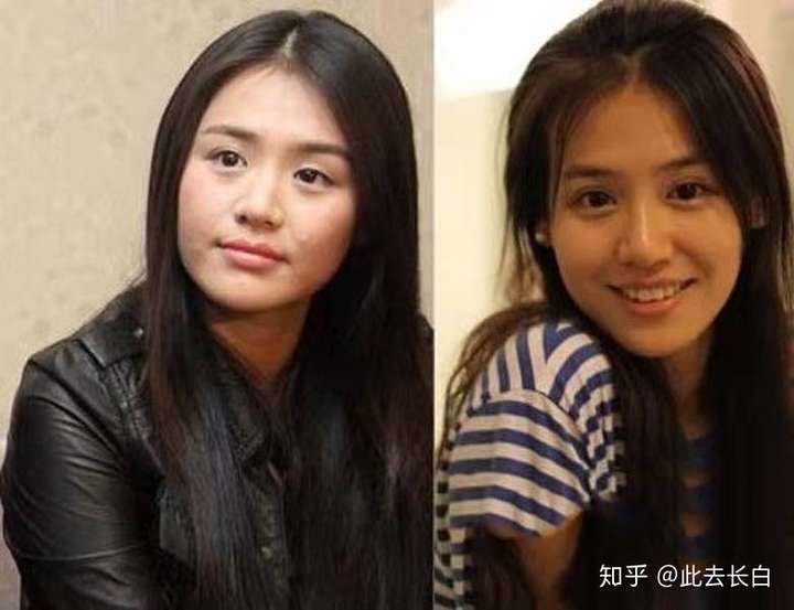 整容成功的明星案例都有哪些?
