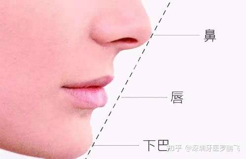 如何判断自己嘴凸?