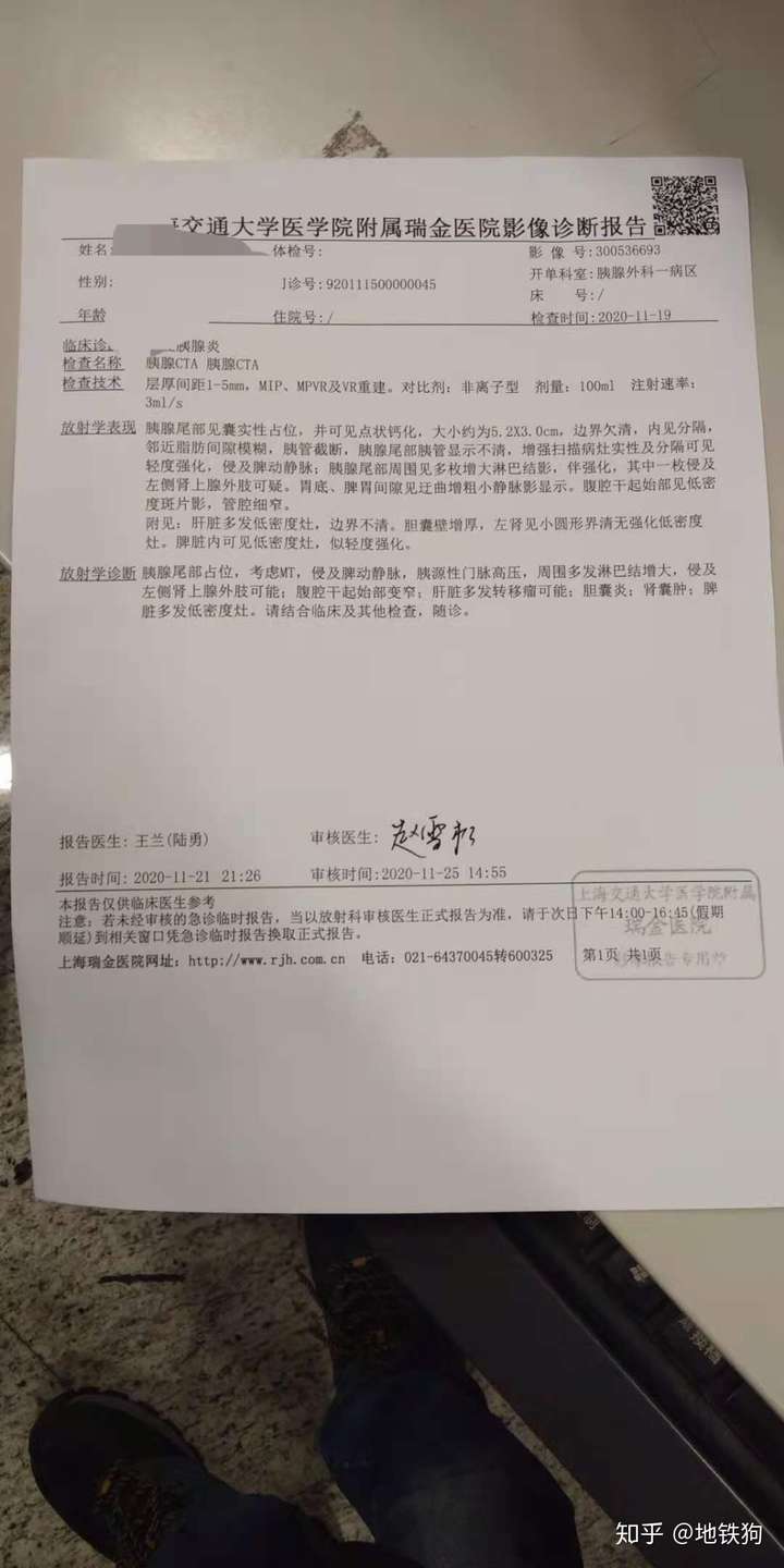 你知道的胰腺癌患者都活了多久