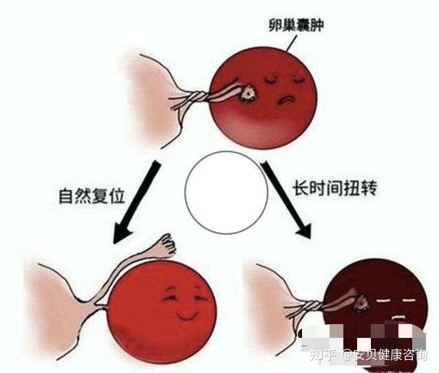 1,环境与饮食:恶劣的环境可能影响女性生殖系统的机能鞋干扰激素分泌