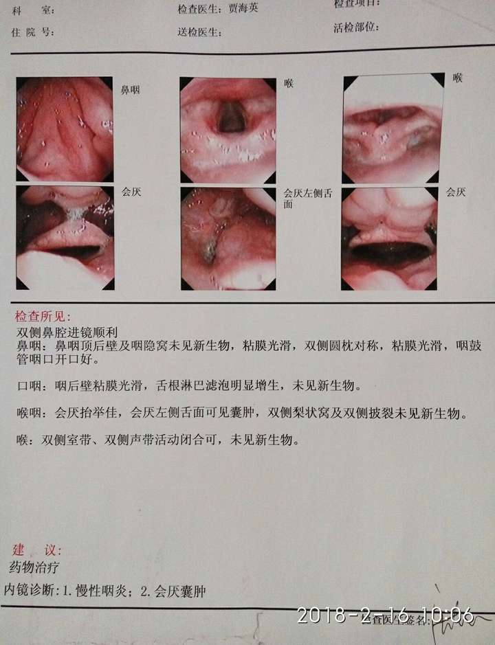 慢性咽喉炎如何减轻病症,最好能根治?