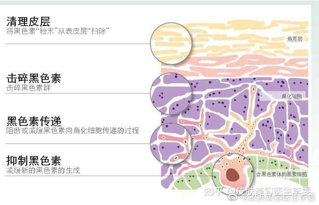 途径1:剥脱带有黑色素颗粒的角质层