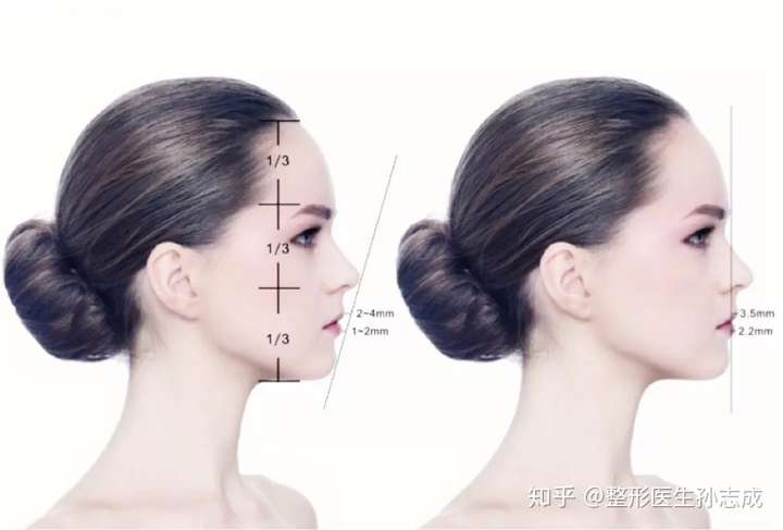 完美侧颜杀需要满足四个条件:饱满协调的额头,长度比例适中的下巴,高