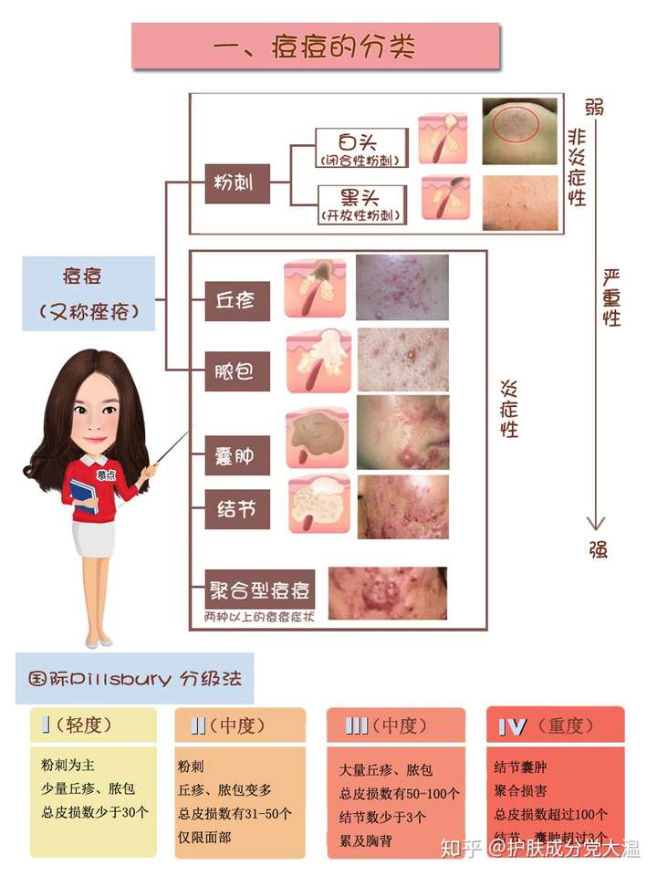 1,首先要看看自痤疮是怎样一个情况.可以参考常见的痘痘分级.