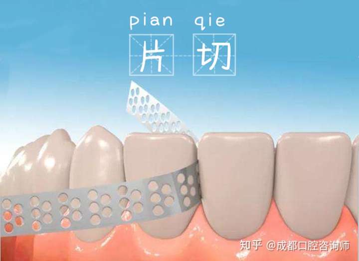 正畸做片切危害大吗