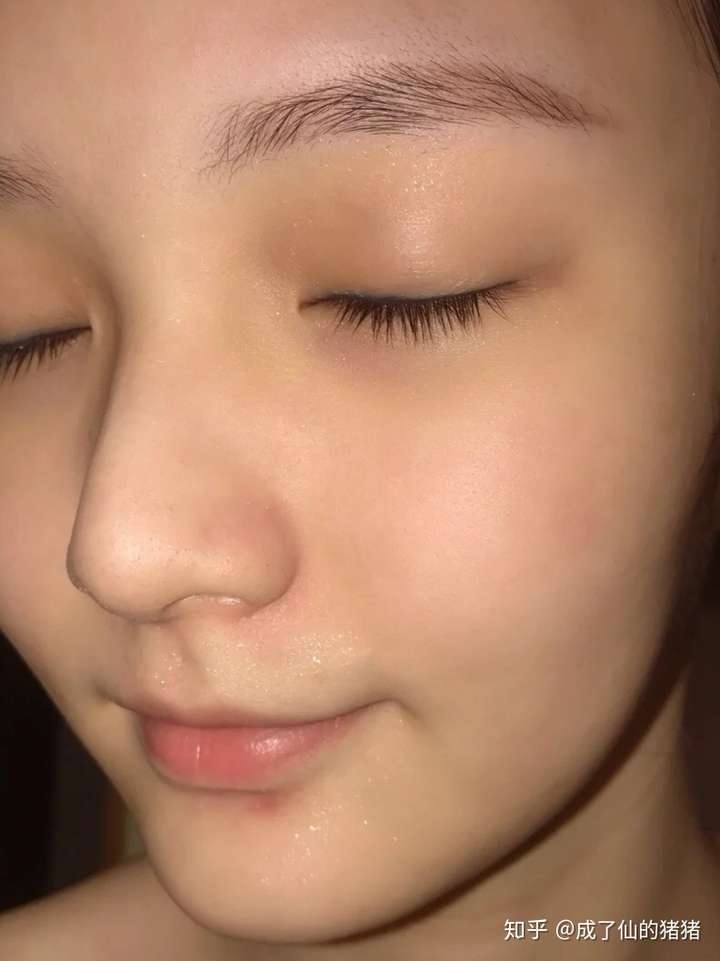 皮肤暗沉发黄怎么办?