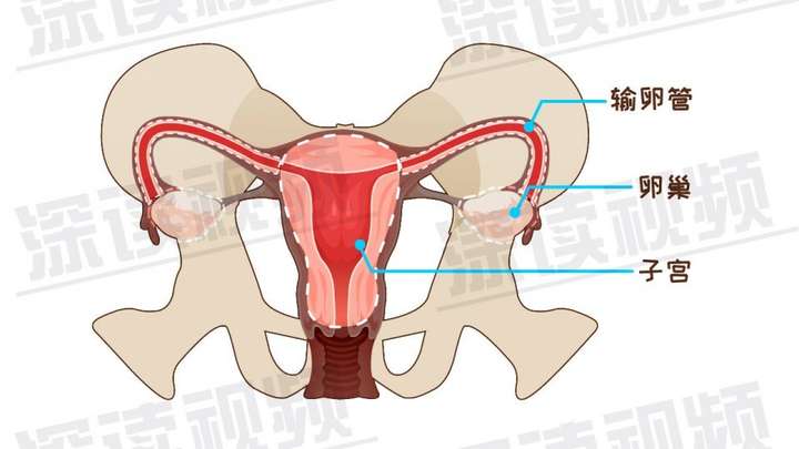 输卵管是卵子从卵巢到子宫的通道,子宫两侧各一条,长8—14cm.