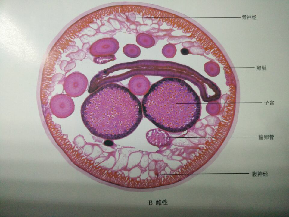 这两张环毛蚓的横切面图中分别可以看出什么结构