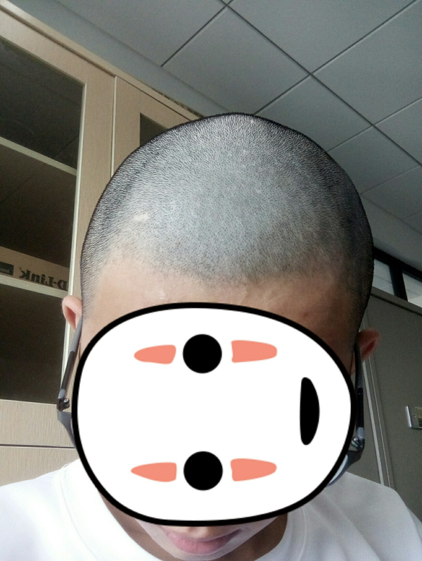 男生光头是种什么体验?