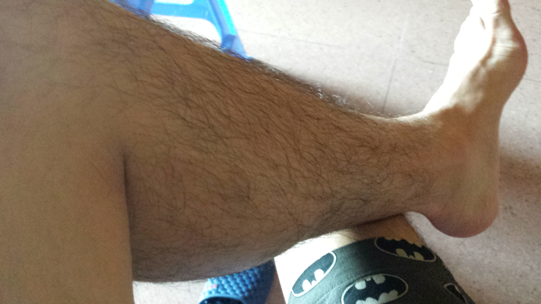 <em>男生</em>夏天想<em>穿短裤腿毛</em>浓郁到底该不该剃掉? -