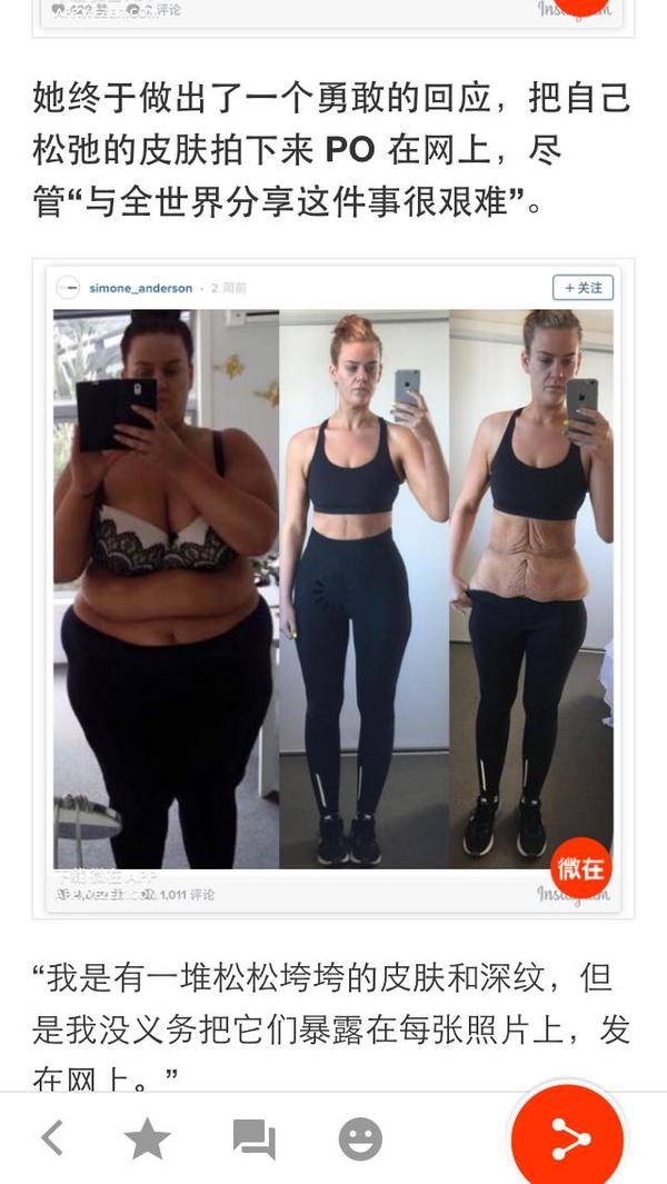 怎样瘦下来后皮肤紧致 9682a3ffe834118d2da3d3eac810b07c_b.jpg