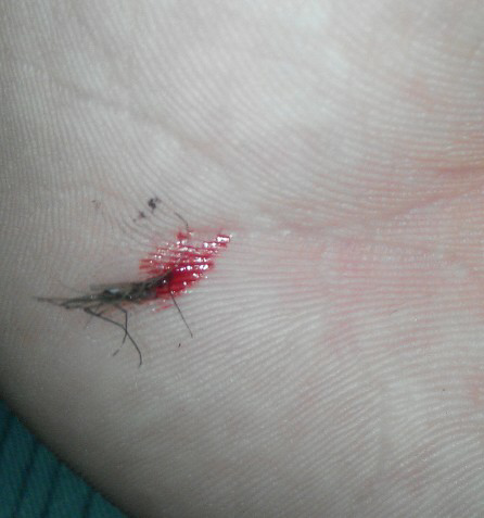 睡觉时蚊子在耳边飞,开灯后却很难找到,它藏在