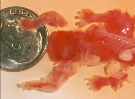 打掉第一胎有什么危害?会不会让第二胎更容易