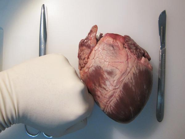 工具:剪刀一把和手术刀一把~ 正常的心脏就是这样,深色的红色部分是