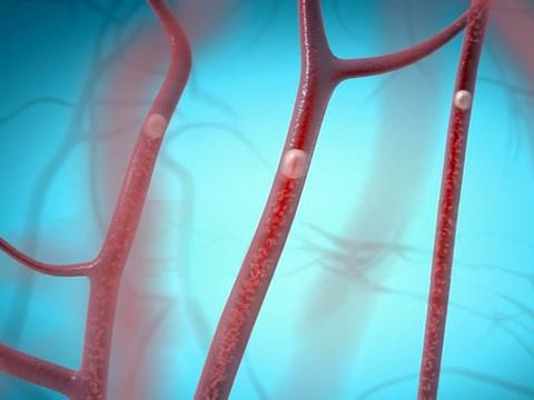 向人的静脉注射一管空气可以杀人?什么原理?