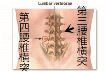 腰肌劳损正确的康复方法是什么?