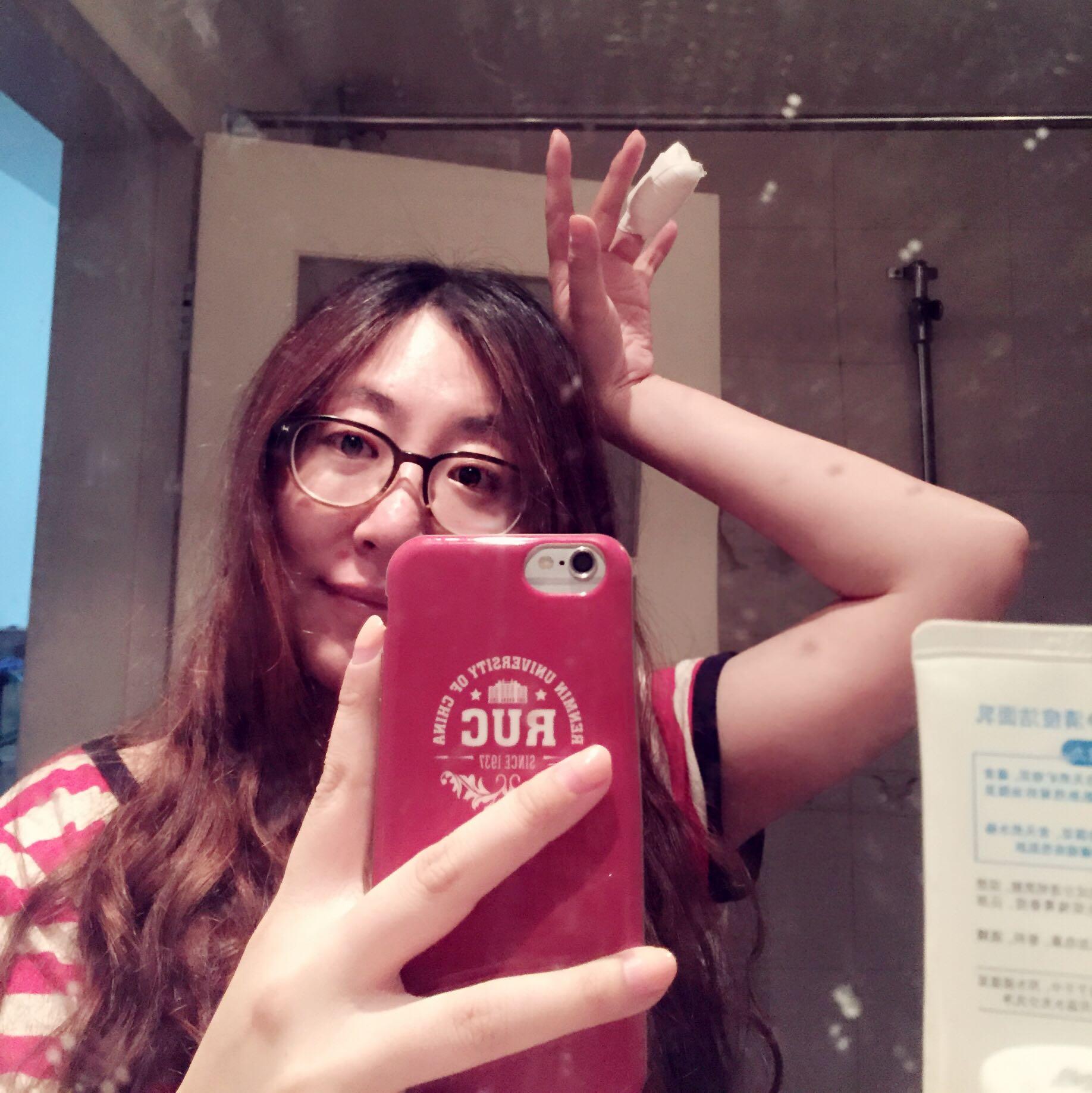 拔指甲是什么样的体验?很疼么? - 崔洋的回答 