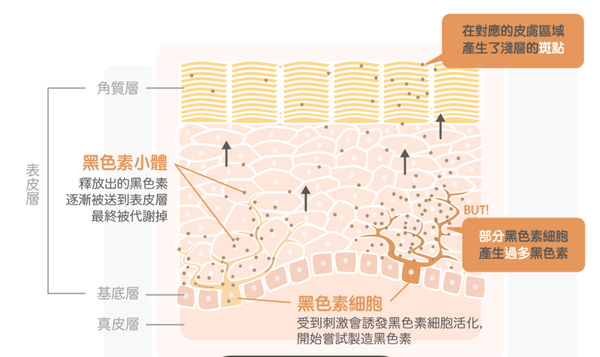 雀斑的成因预防与治疗图文全雀斑的成因出现位置与特点