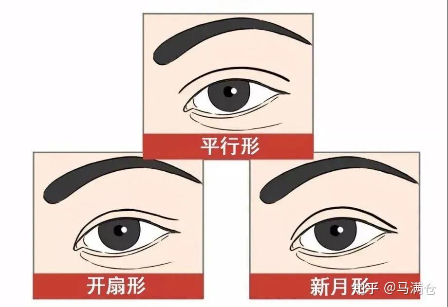 眼睑分上睑和下睑.