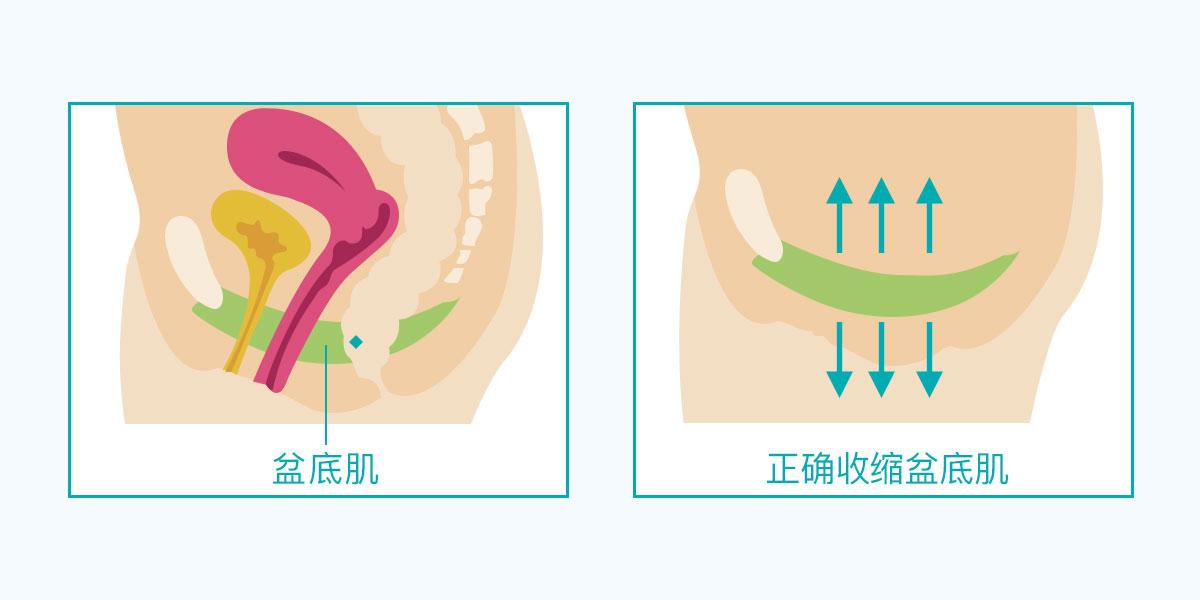 产后盆底肌最佳修复时间是什么时候千万不要错过