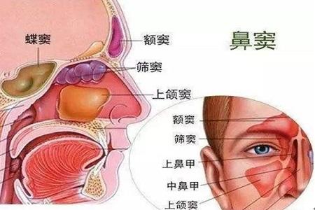 首大陈潜鼻窦炎正确的体位引流方法及按摩方法