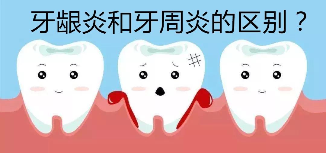 牙龈炎和牙周炎的区别是什么?(病理,诊断,表现,发展和治疗)