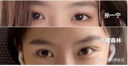 你们觉得孙一宁颜值做过整形吗?