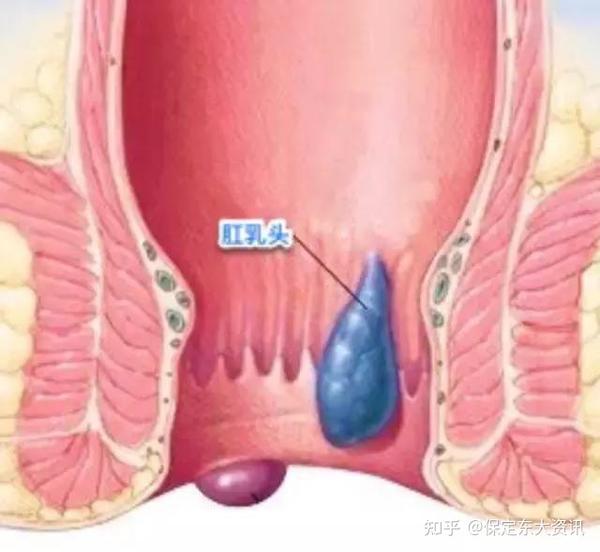 问  便后脱出肛门的东西是什么?