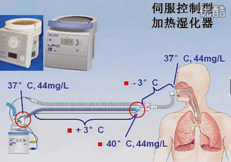 气道湿化治疗