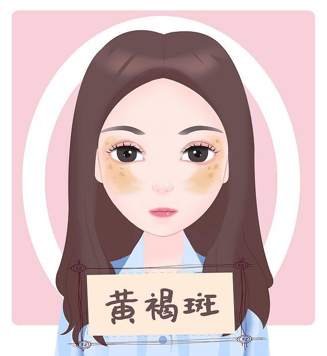 黄褐斑气虚血瘀清代名医留下的验方活血化瘀排毒化斑