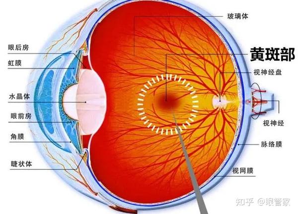 青光眼