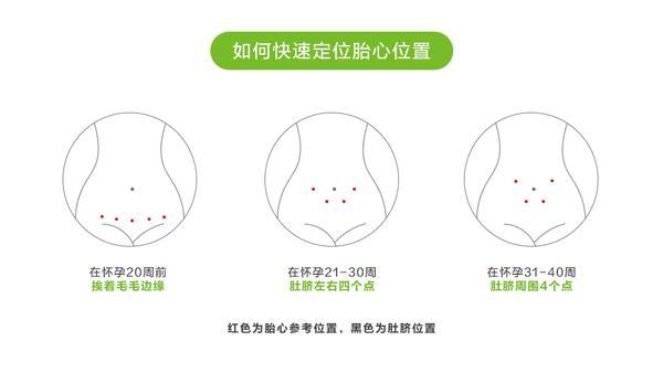 居家远程胎心监护如何使用家用胎心监护仪做胎心监护