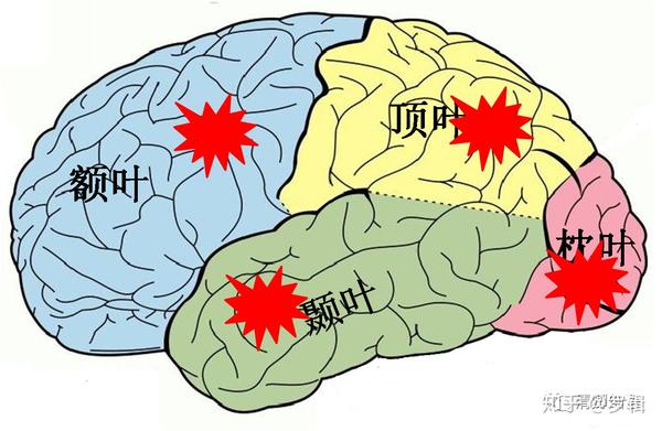 癫痫发作与大脑功能