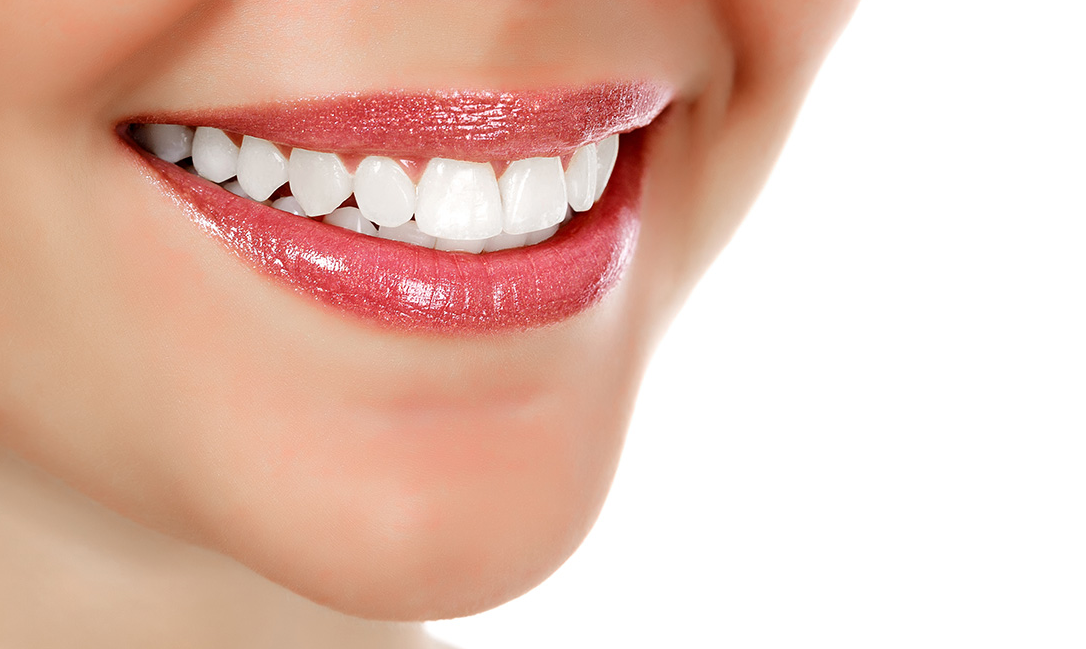 纽佳菲丨李佳琦的大白牙引发关注这些美白牙齿的方式你了解多少