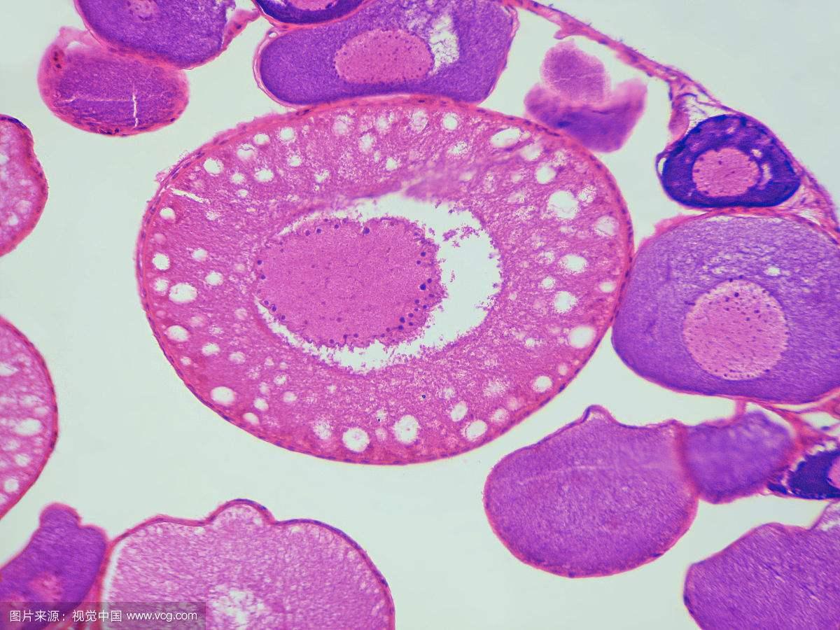 对于不孕以及试管人群,不只要关注卵子质量,还要留意卵泡的发育,毕竟