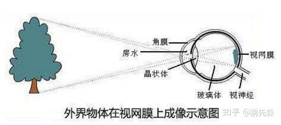 屈光度是什么?