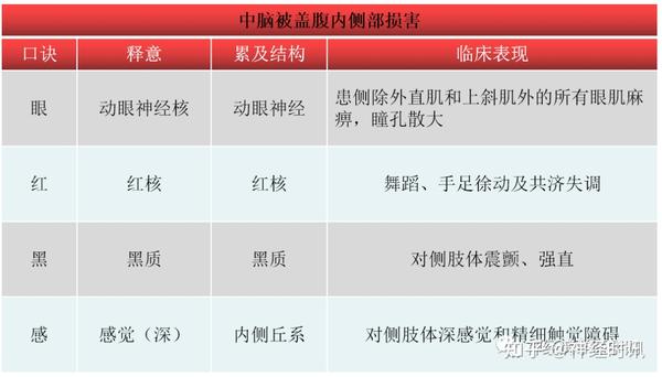 脑干综合征入门级记忆【易记简约版】