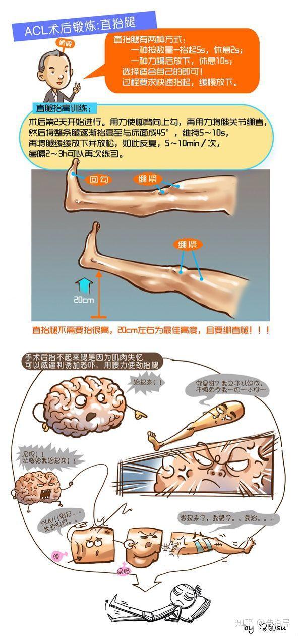 前交叉韧带重建的术前准备与术后康复(漫画版)