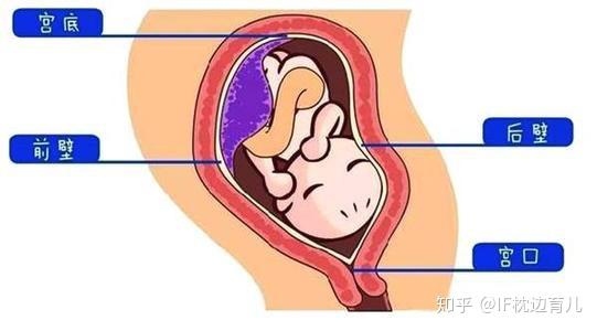 怀孕4个月孕妈一直在干活和胎盘后壁有关系吗科学解释在这里