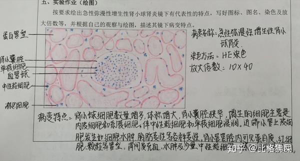 病理学实验红蓝铅笔图