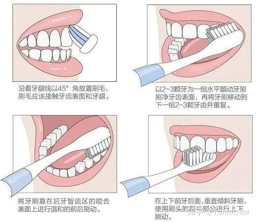 正确的刷牙方式——巴斯刷牙法