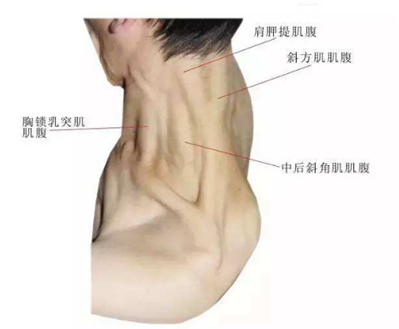 第四,纠正头部正常位置,保持耳垂和肩峰在一条直线上,可以使斜角肌的
