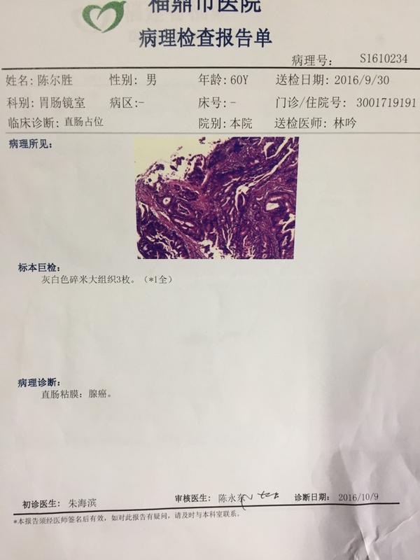 直肠癌报告单 - 知乎