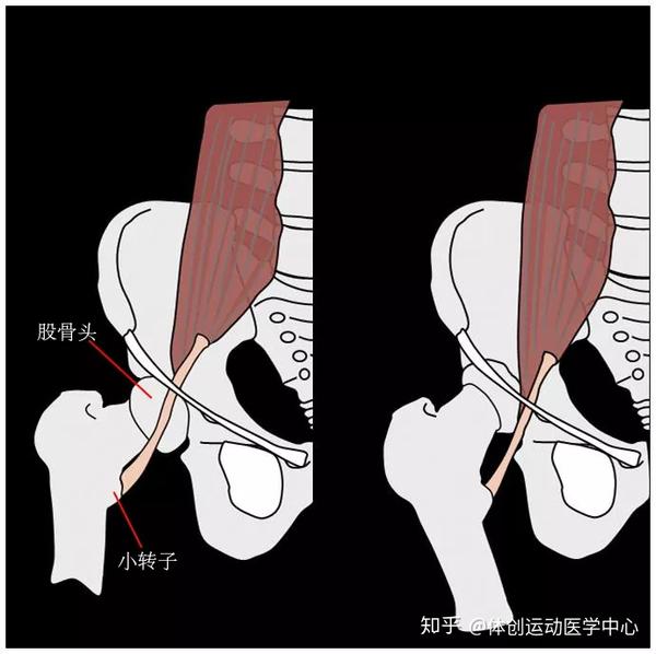 弹响髋怎么治