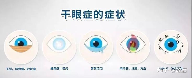 eos强脉冲光你知道为什么会得干眼症吗